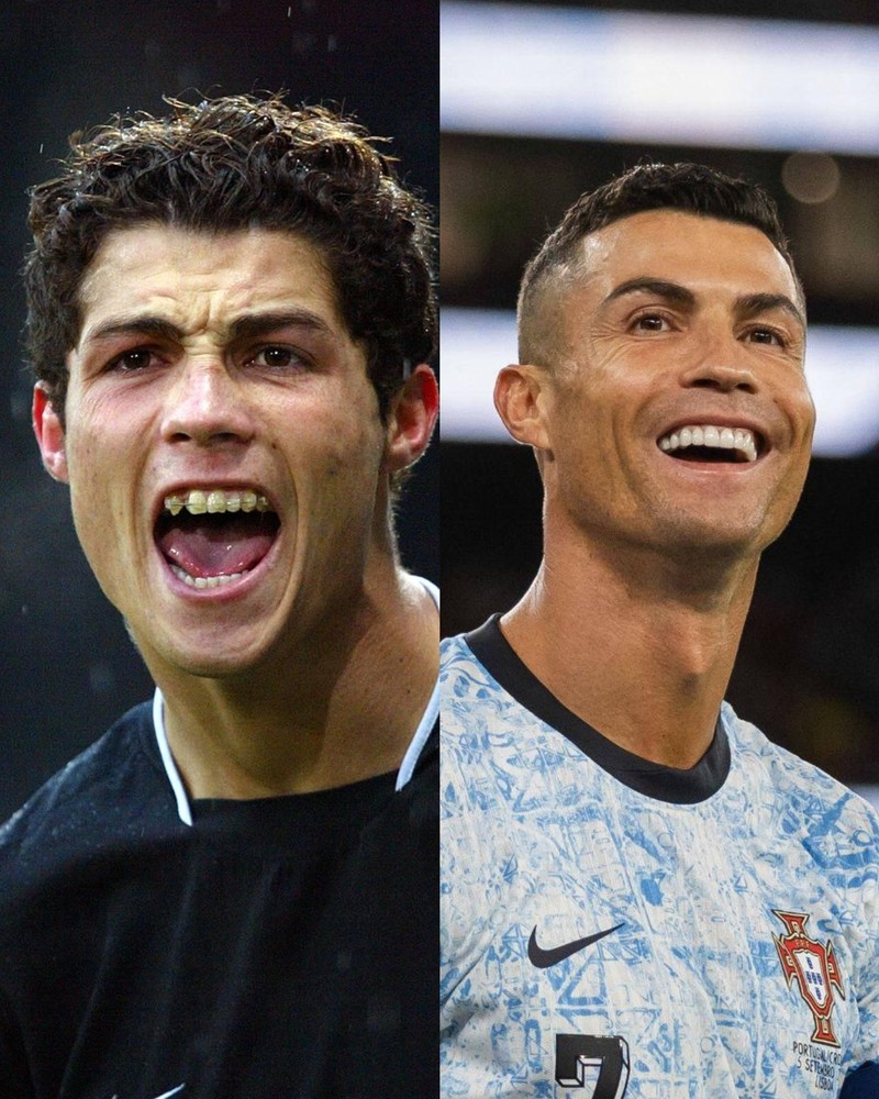 Die auffälligste Veränderung in Cristiano Ronaldos Gesicht sind seine Zähne.