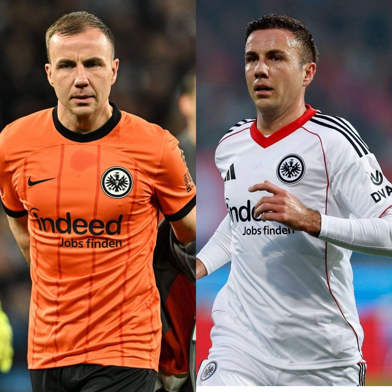 Mario Götze unterzog sich 2025 einer Haartransplantation und geht offen damit um.