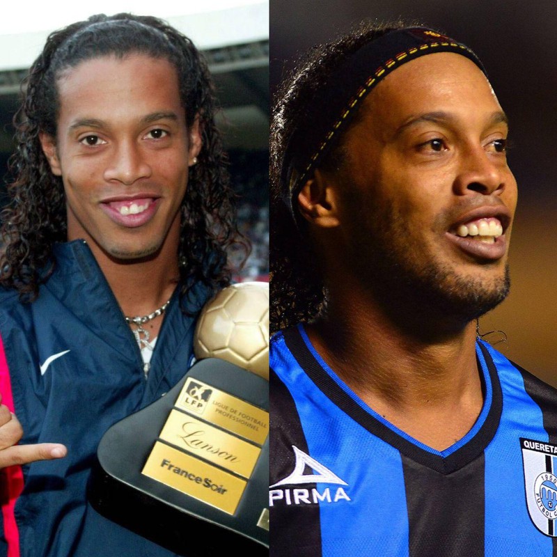 Ronaldinho, der sich wegen seiner Zähne operieren ließ
