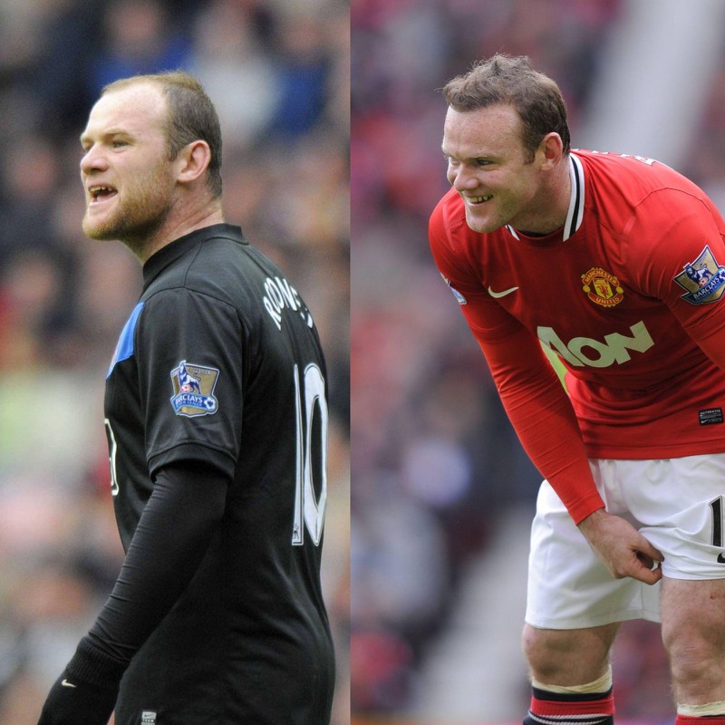 Wayne Rooney ließ sich 2011 die Haare transplantieren, weil er unzufrieden war.