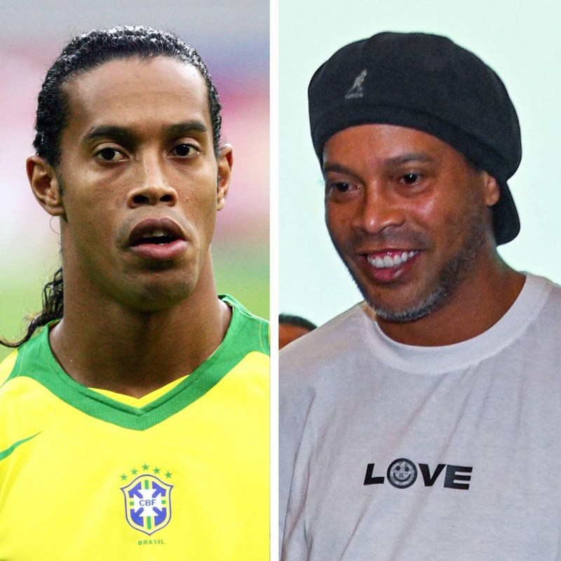 Der ehemalige Fußballer Ronaldinho hat sich sehr verändert.