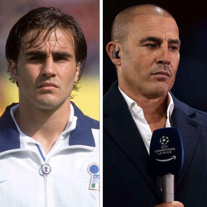 Fabio Cannavaro hat heute eine Glatze, nachdem er als junger Mann mit langen Haaren bekannt wurde.