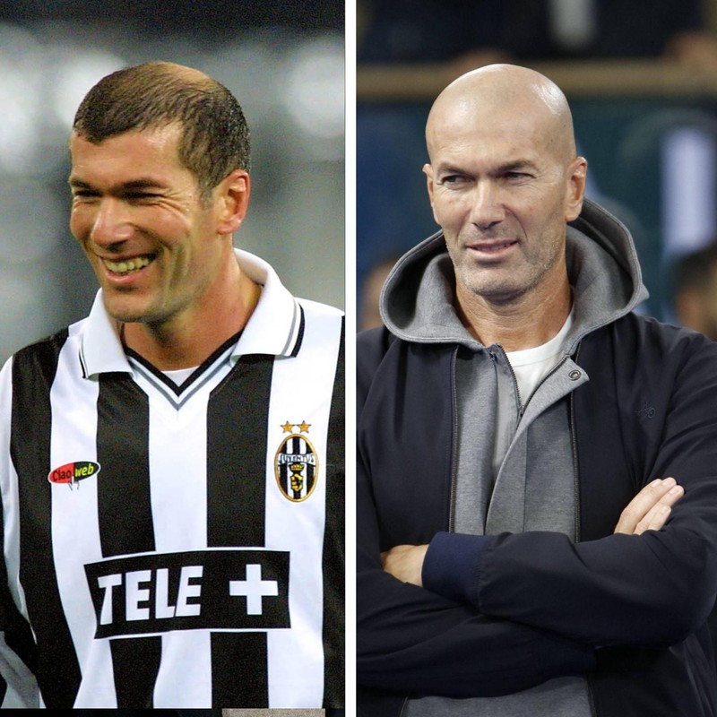 Zinédine Zidane trägt als Profi-Fußballer Haare, später kommt er zur Glatze.